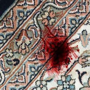 پاک کردن لکه خون از فرش