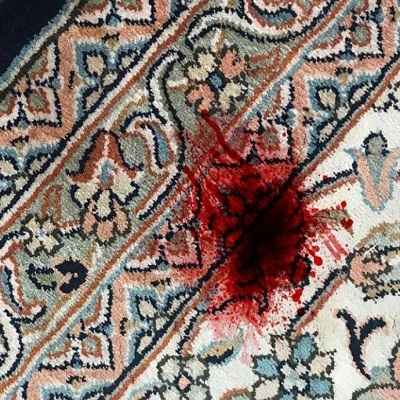 پاک کردن لکه خون از فرش
